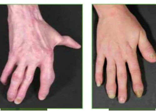 刘峰广场舞 刘峰广场舞天河动作分解 刘峰广场舞 刘峰广场舞天河动作分解